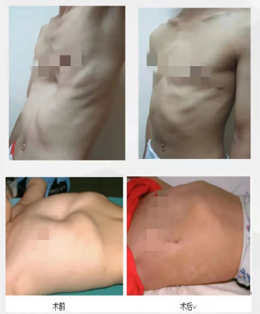 QQ截图20220822151932.png